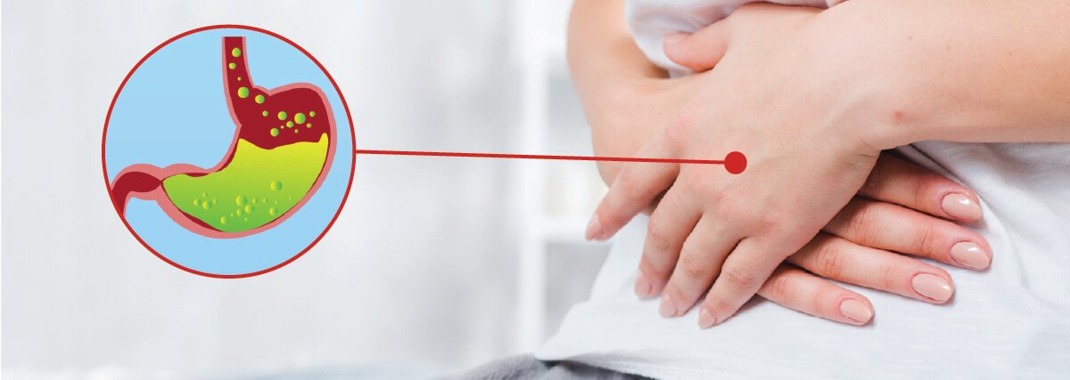 Foods that cause GERD and Acid Reflux