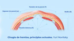 Reconstrucción de la pared abdominal