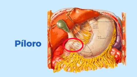 Gastroparesia: píloro