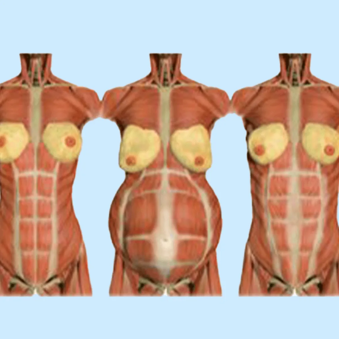estiramientos de la pared abdominal