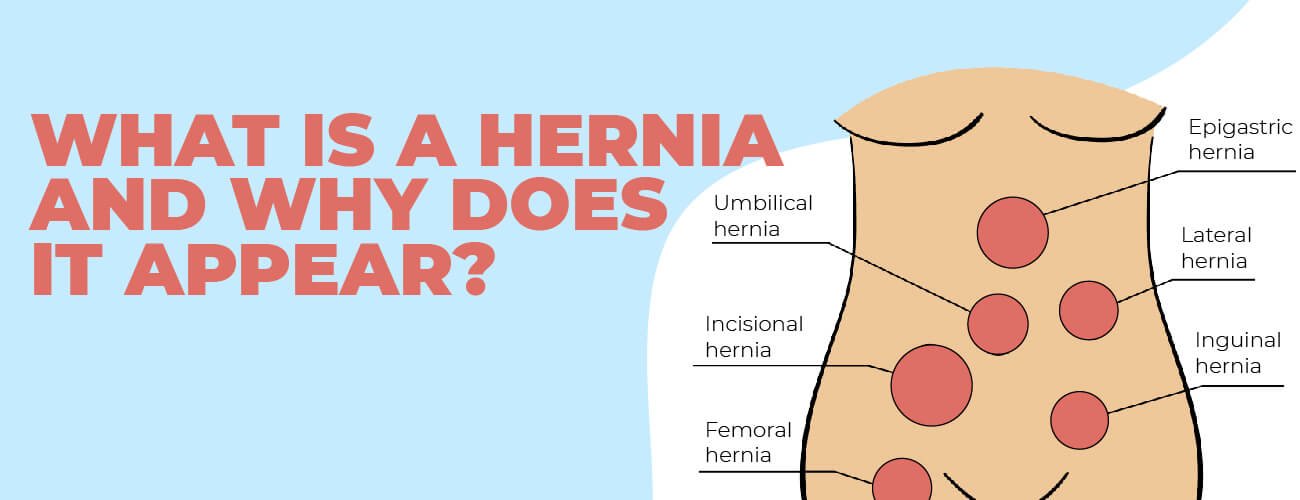 What is a hernia