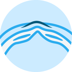 Abdominal wall reconstruction