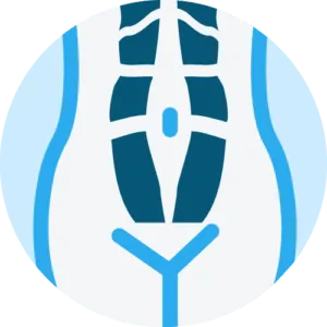 Diastasis recti