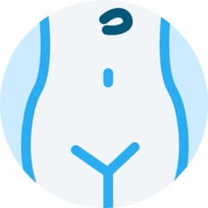 Epigastrical hernia Repair