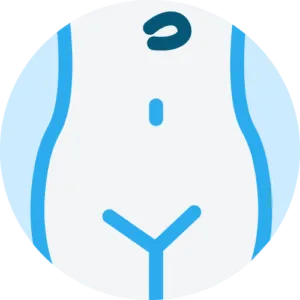 Epigastrical hernia Repair