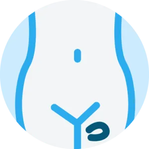 Femoral hernia Repair
