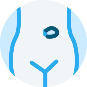 umbilical hernia repair