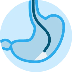 endoscopia