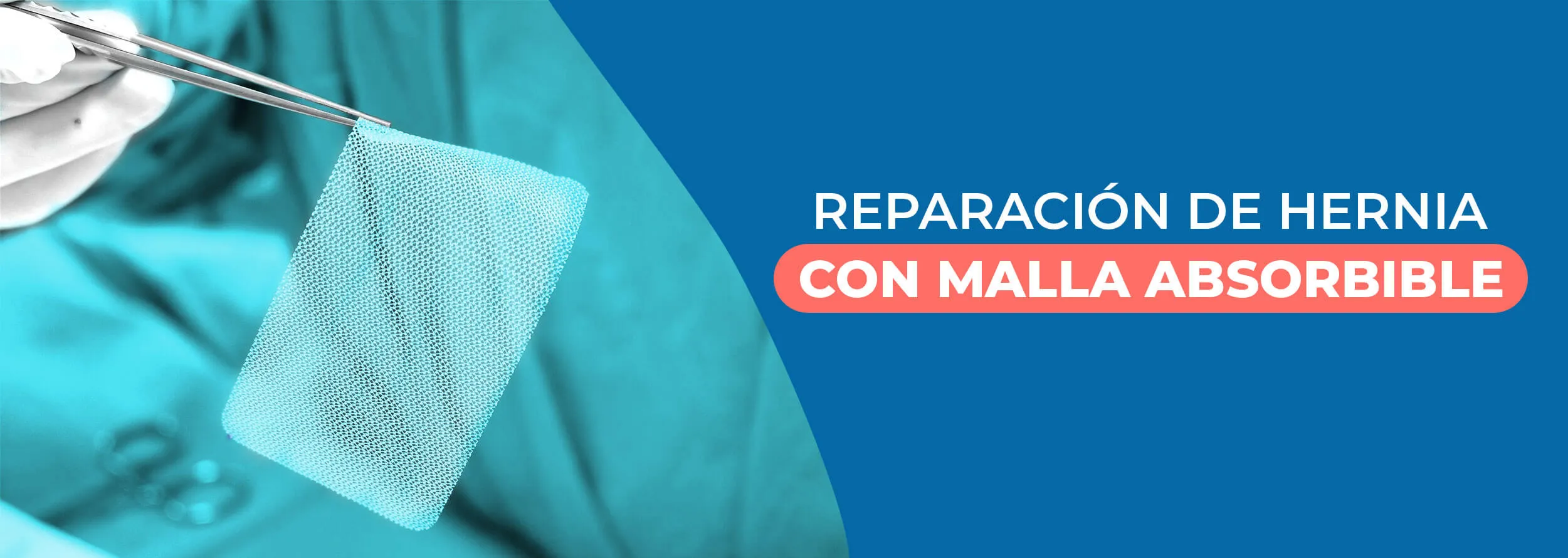 Reparación de hernia con malla absorbible