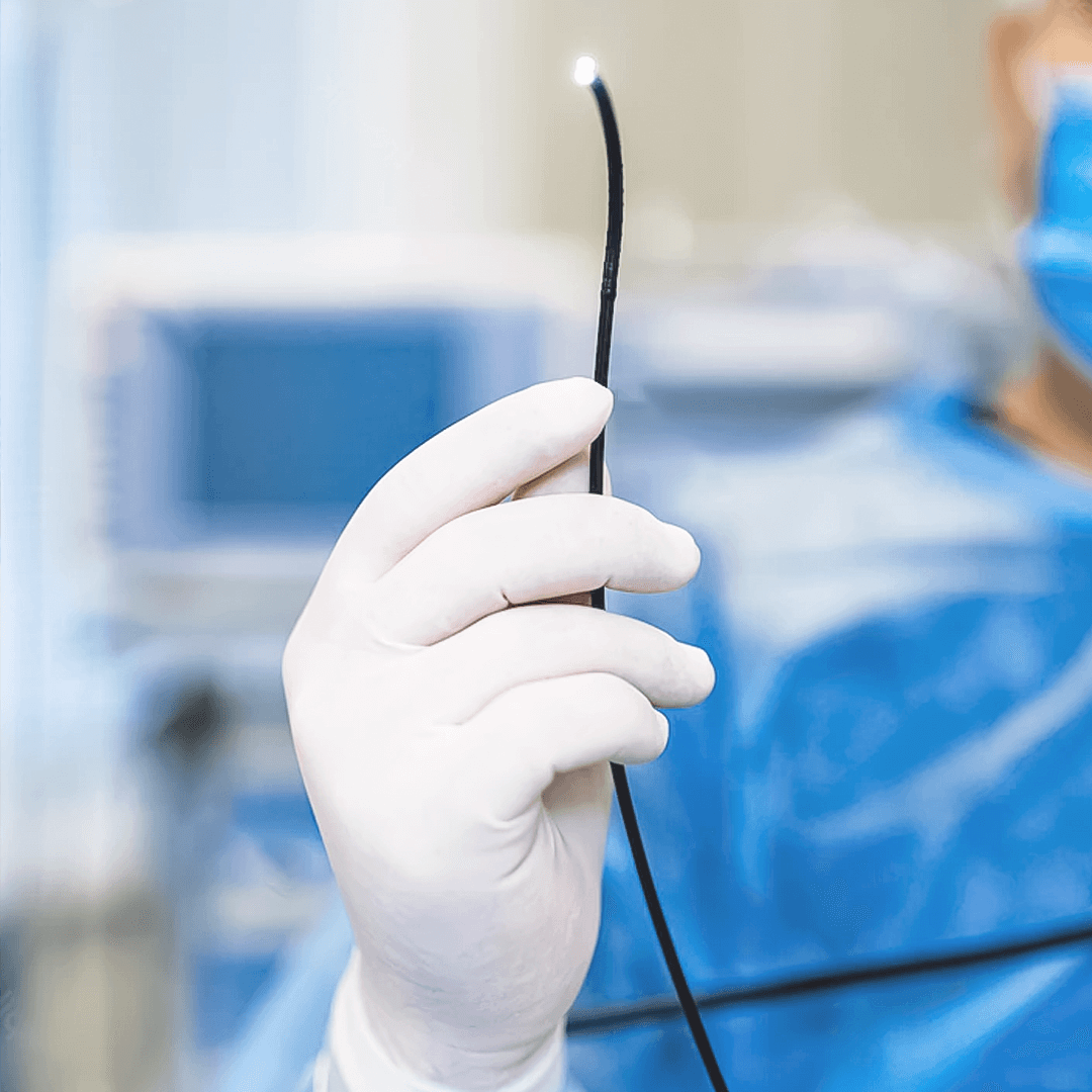 WHAT IS UPPER ENDOSCOPY?