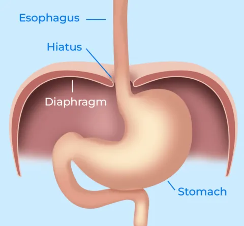 Normal hiatal